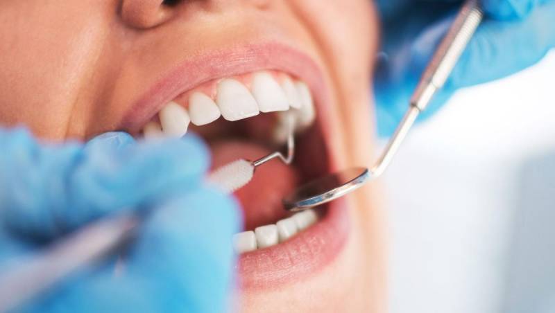 Souscrivez une assurance de prêt des Jeunes Dentistes avec MEDICASSURE